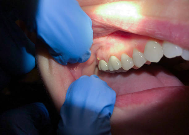 Best After-Hours Dental Trauma Care in Pine Brook, NJ