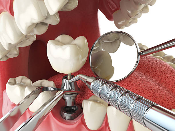 Best Same-Day Emergency Dental Services in Pine Brook, NJ